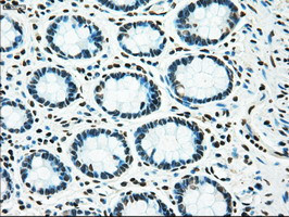 TYRO3 Antibody in Immunohistochemistry (Paraffin) (IHC (P))