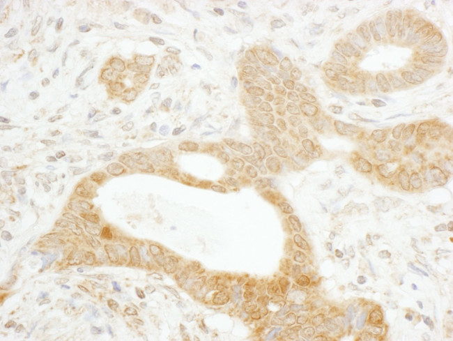 Tankyrase 1 Antibody in Immunohistochemistry (IHC)