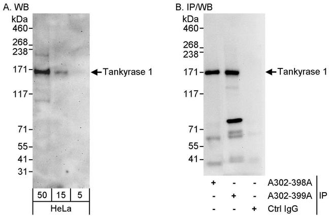 Tankyrase 1 Antibody in Western Blot (WB)