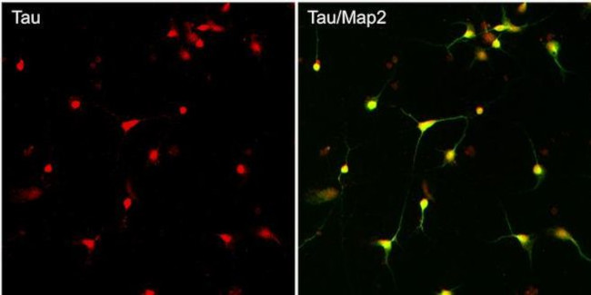 Tau Antibody in Immunocytochemistry (ICC/IF)