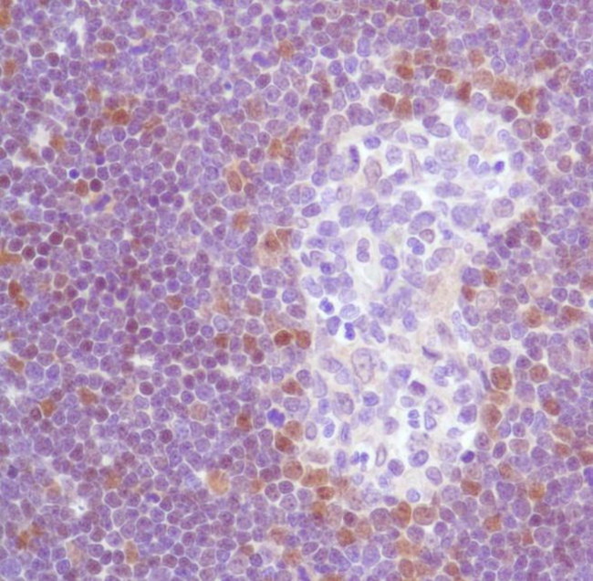 TdT Antibody in Immunohistochemistry (IHC)