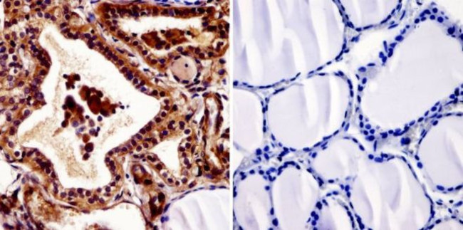 THRA/THRB Antibody in Immunohistochemistry (Paraffin) (IHC (P))