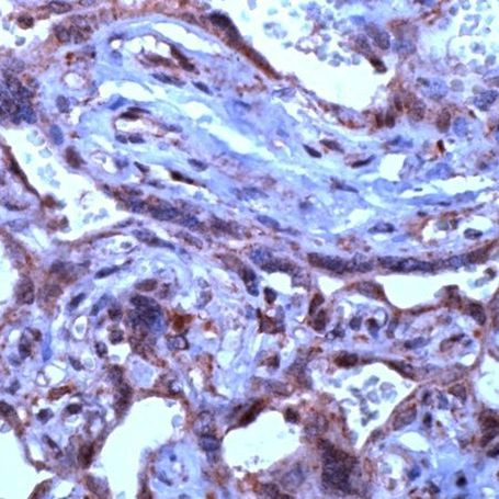 TGF beta-3 Antibody in Immunohistochemistry (IHC)