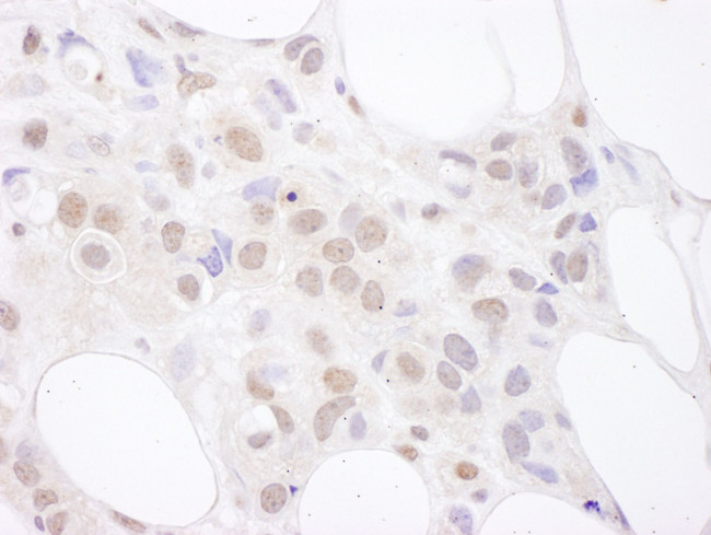 U2AF65 Antibody in Immunohistochemistry (IHC)