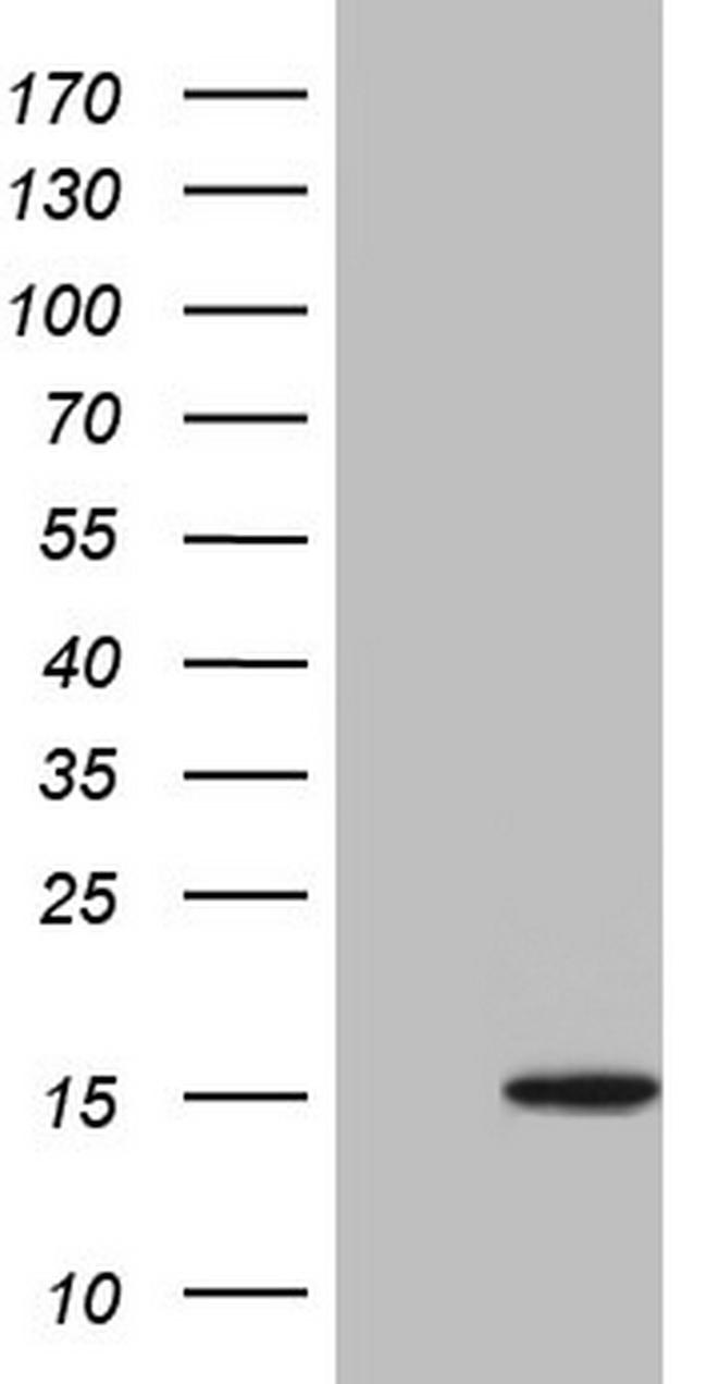 UBA52 Antibody in Western Blot (WB)