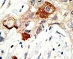 UBC9 Antibody in Immunohistochemistry (IHC)