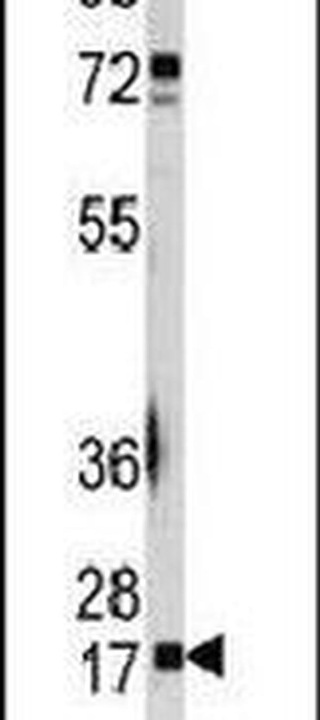 UBC9 Antibody in Western Blot (WB)