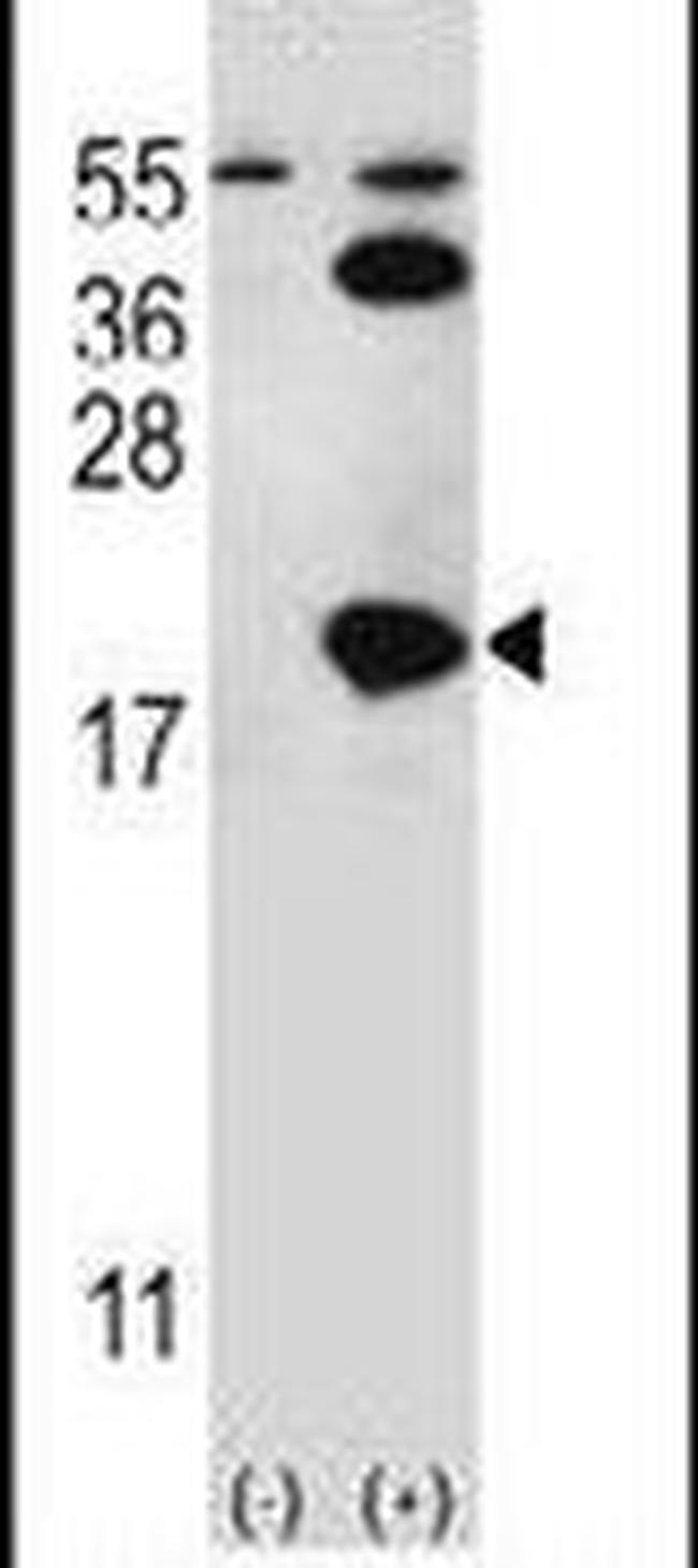 UBC9 Antibody in Western Blot (WB)