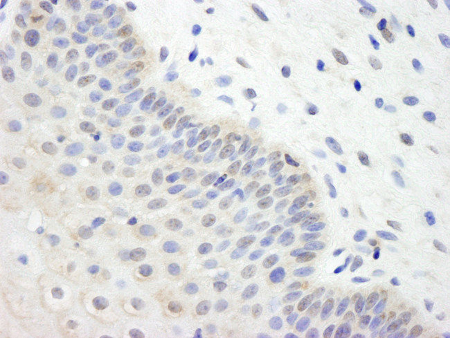 UBCH7 Antibody in Immunohistochemistry (IHC)