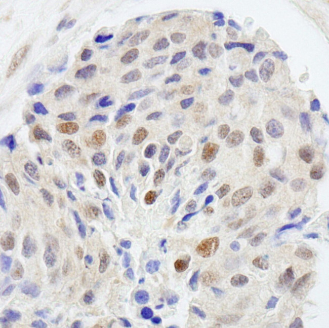 UBE1 Antibody in Immunohistochemistry (IHC)