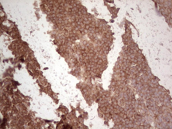 UBE2D2 Antibody in Immunohistochemistry (Paraffin) (IHC (P))