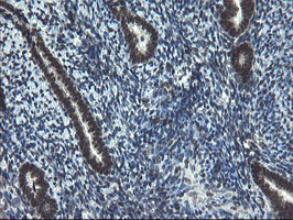 UBE2E3 Antibody in Immunohistochemistry (Paraffin) (IHC (P))