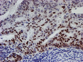 UBE2E3 Antibody in Immunohistochemistry (Paraffin) (IHC (P))