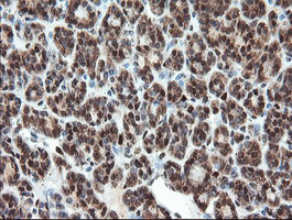 UBE2E3 Antibody in Immunohistochemistry (Paraffin) (IHC (P))