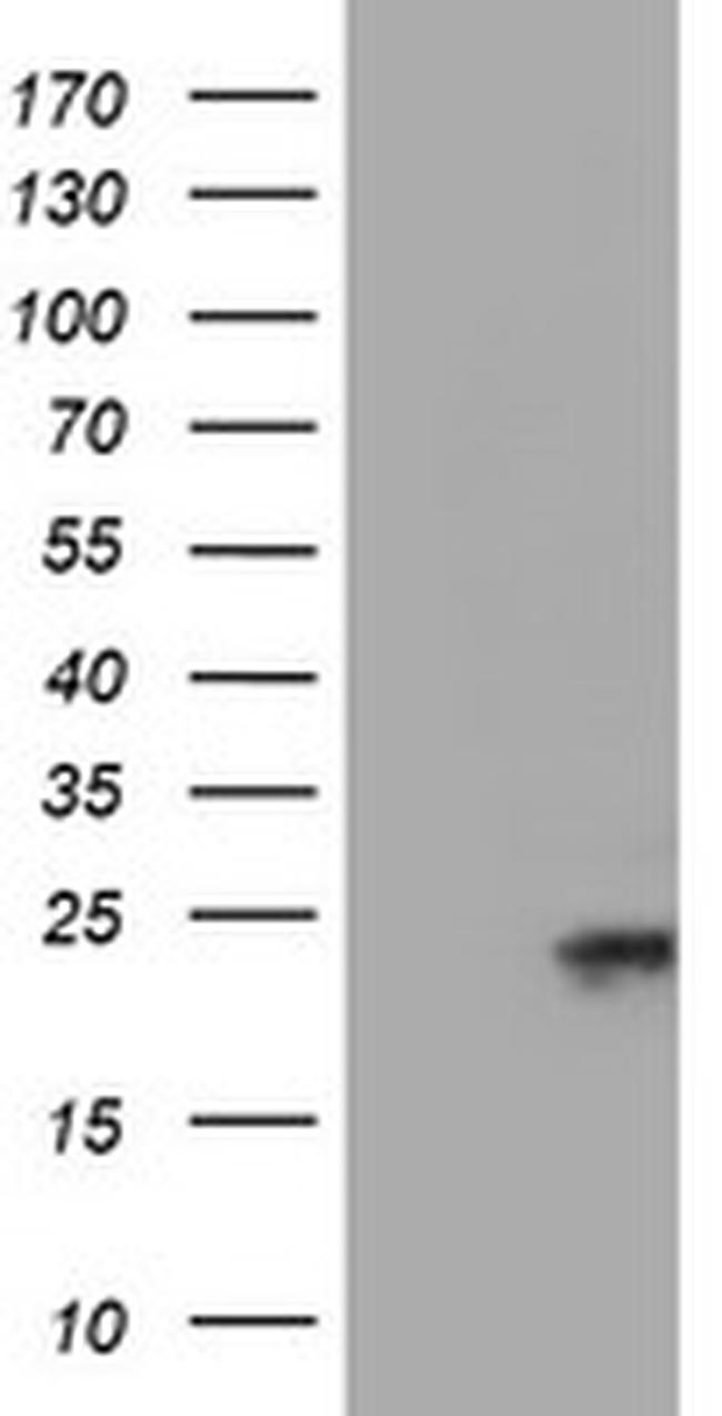 UBE2E3 Antibody in Western Blot (WB)