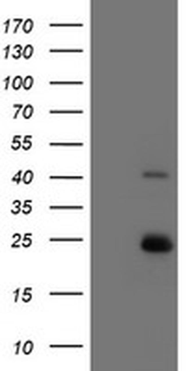 UBE2E3 Antibody in Western Blot (WB)
