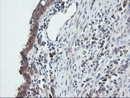 UBE2G2 Antibody in Immunohistochemistry (Paraffin) (IHC (P))