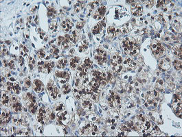 UBE2G2 Antibody in Immunohistochemistry (Paraffin) (IHC (P))