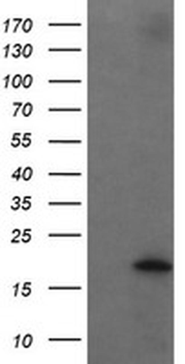 UBE2G2 Antibody in Western Blot (WB)