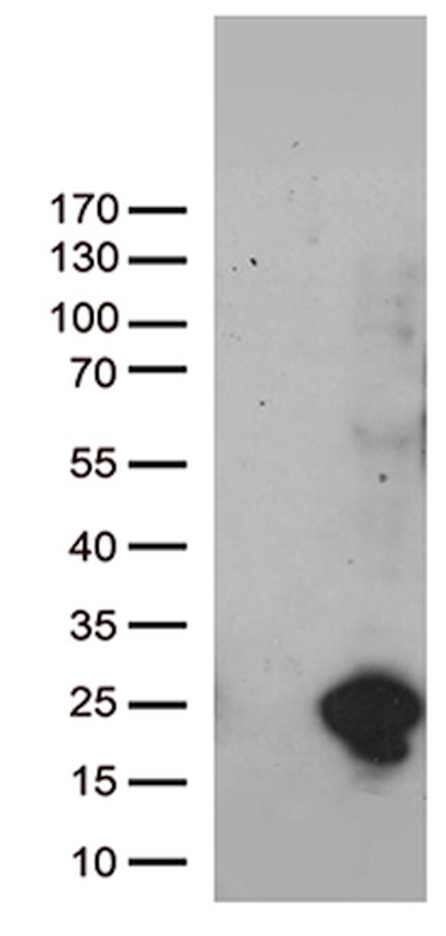 UBE2NL Antibody in Western Blot (WB)