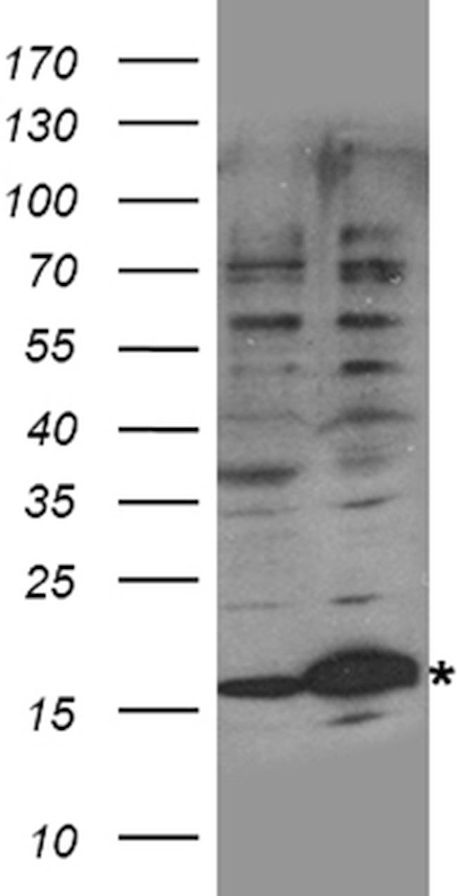UBE2NL Antibody in Western Blot (WB)