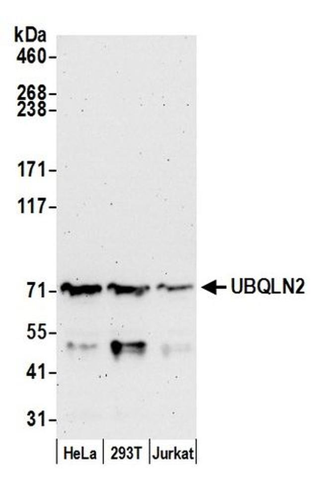 UBQLN2 Antibody in Western Blot (WB)