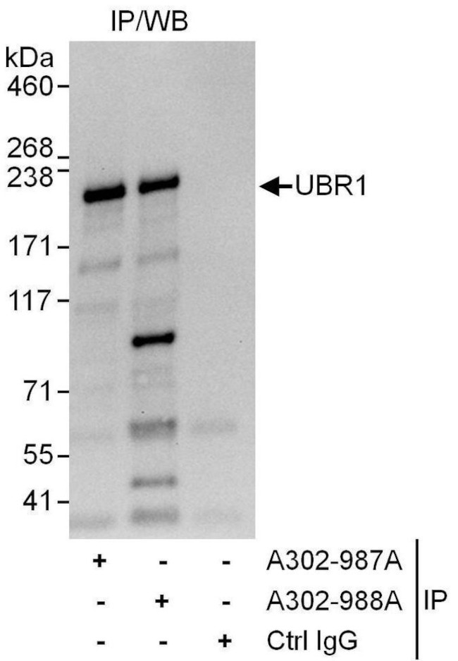 UBR1 Antibody in Immunoprecipitation (IP)