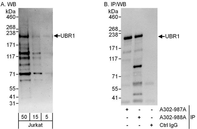 UBR1 Antibody in Western Blot (WB)