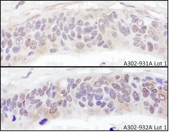 UBXD1 Antibody in Immunohistochemistry (IHC)