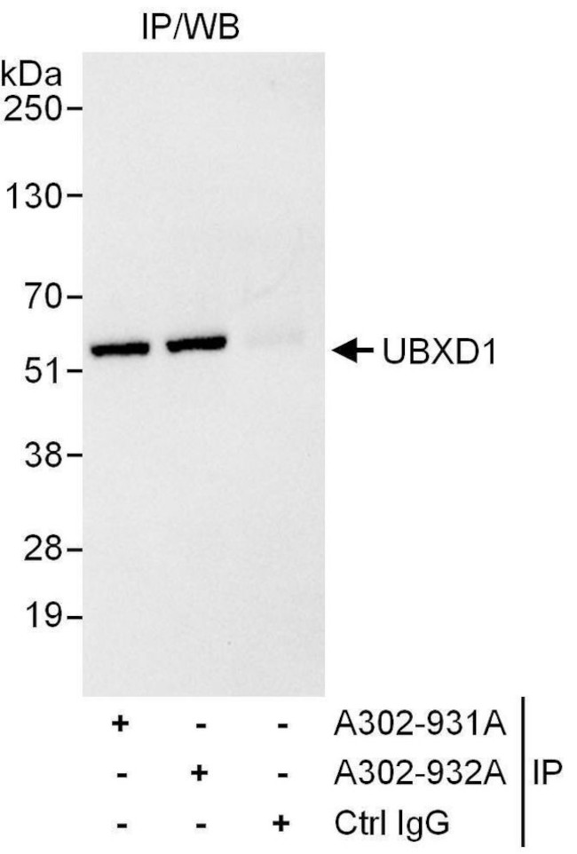 UBXD1 Antibody in Immunoprecipitation (IP)