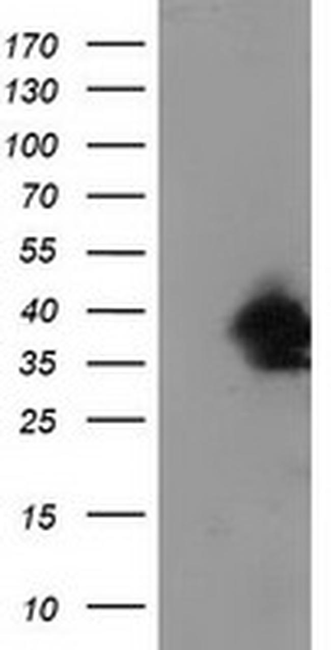 UBXN2B Antibody in Western Blot (WB)