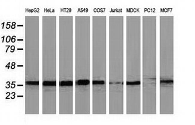 UBXN2B Antibody in Western Blot (WB)