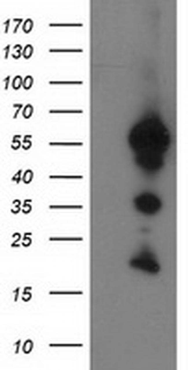 UBXN2B Antibody in Western Blot (WB)