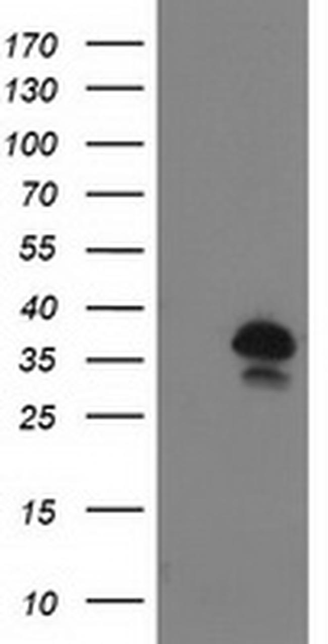 UBXN2B Antibody in Western Blot (WB)