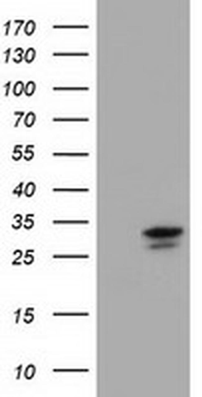 UCK1 Antibody in Western Blot (WB)