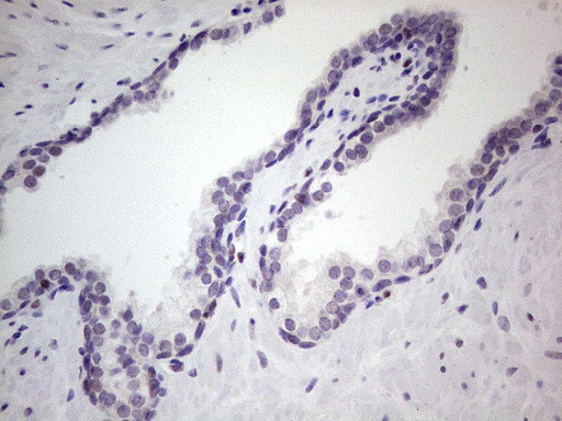 UFD1L Antibody in Immunohistochemistry (Paraffin) (IHC (P))