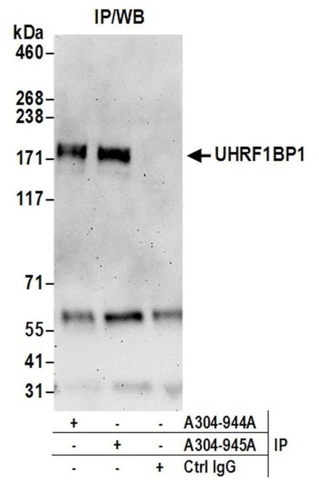 UHRF1BP1L/KIAA0701 Antibody in Immunoprecipitation (IP)