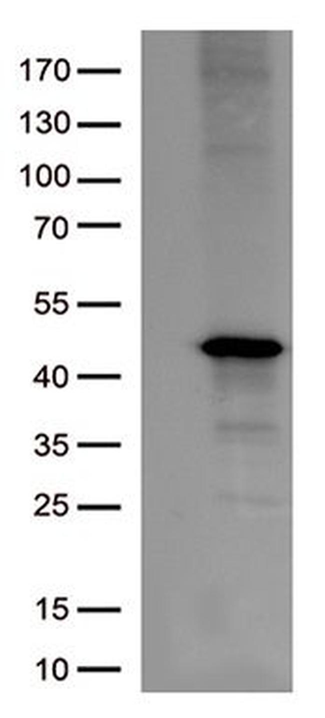 Arginase-1 (ARG1) Antibody in Western Blot (WB)