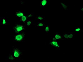 UNG Antibody in Immunocytochemistry (ICC/IF)