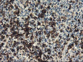 UNG Antibody in Immunohistochemistry (Paraffin) (IHC (P))