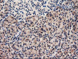 UNG Antibody in Immunohistochemistry (Paraffin) (IHC (P))