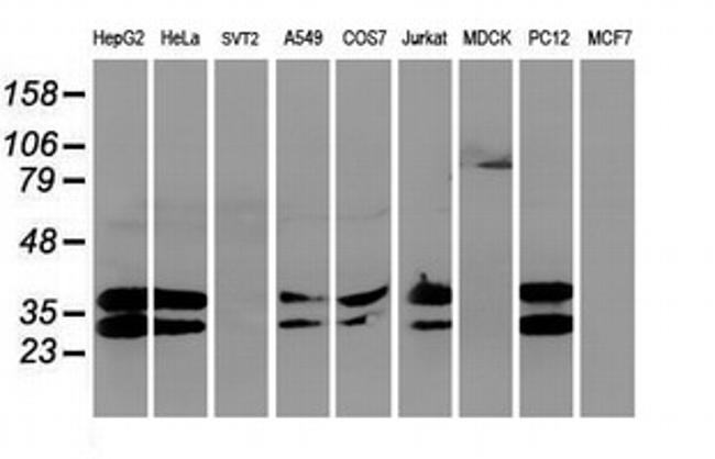 UNG Antibody in Western Blot (WB)