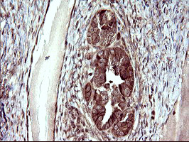 UPRT Antibody in Immunohistochemistry (Paraffin) (IHC (P))