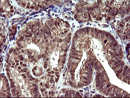 UPRT Antibody in Immunohistochemistry (Paraffin) (IHC (P))