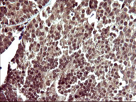 UPRT Antibody in Immunohistochemistry (Paraffin) (IHC (P))