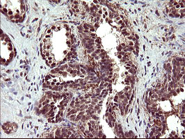 UPRT Antibody in Immunohistochemistry (Paraffin) (IHC (P))