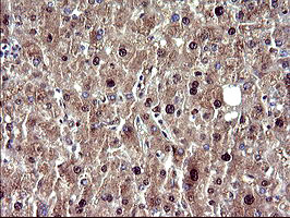 UPRT Antibody in Immunohistochemistry (Paraffin) (IHC (P))