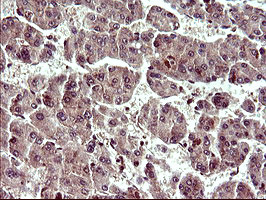 UPRT Antibody in Immunohistochemistry (Paraffin) (IHC (P))