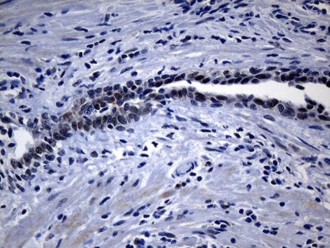 UPRT Antibody in Immunohistochemistry (Paraffin) (IHC (P))