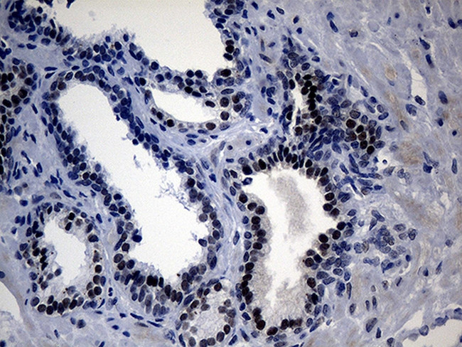 UPRT Antibody in Immunohistochemistry (Paraffin) (IHC (P))